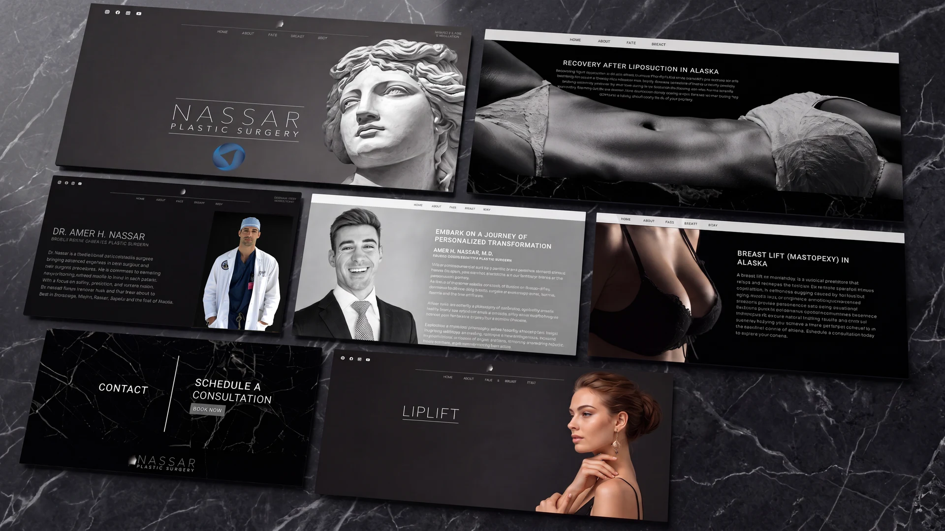 Nassar Plastic Surgery completed website — homepage, procedure pages, and before/after gallery